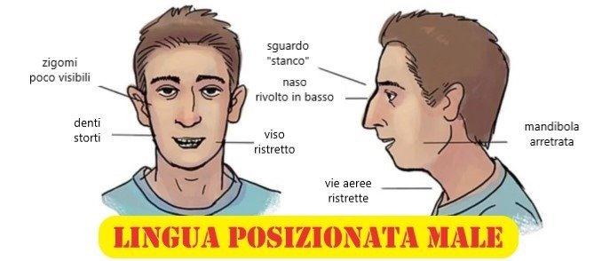 lingua scorretta
